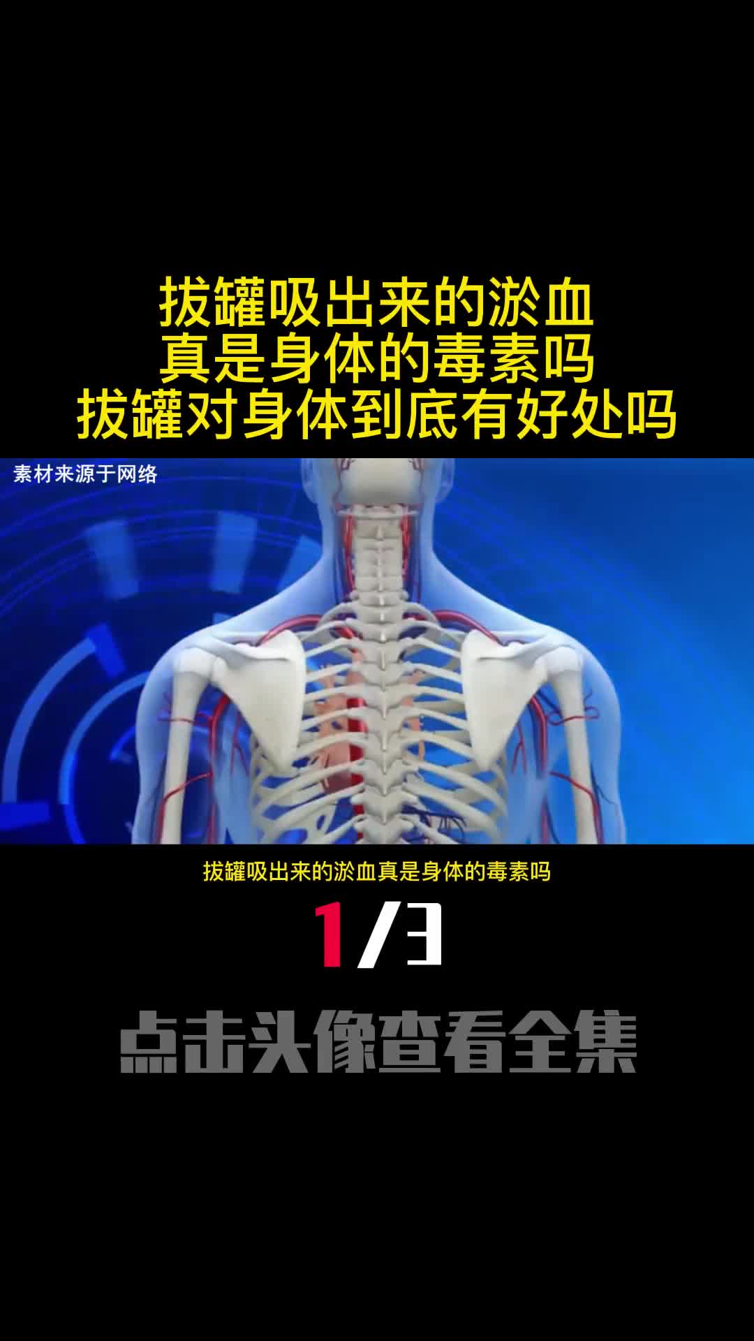 拔罐吸出来的淤血真是身体的毒素吗拔罐对身体到底有好处吗1