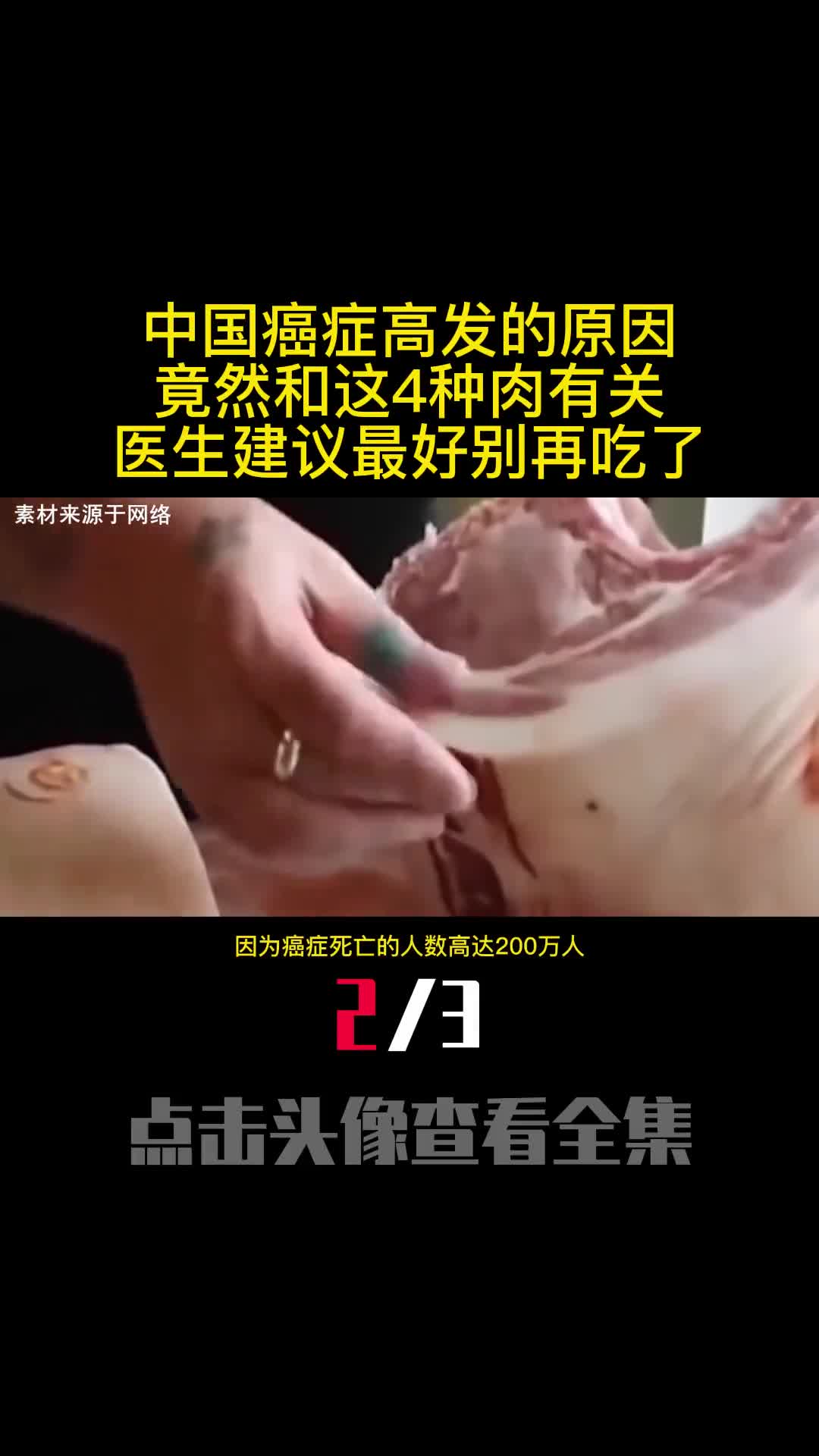 中国癌症高发的原因竟然和这4种肉有关医生建议最好别再吃了2