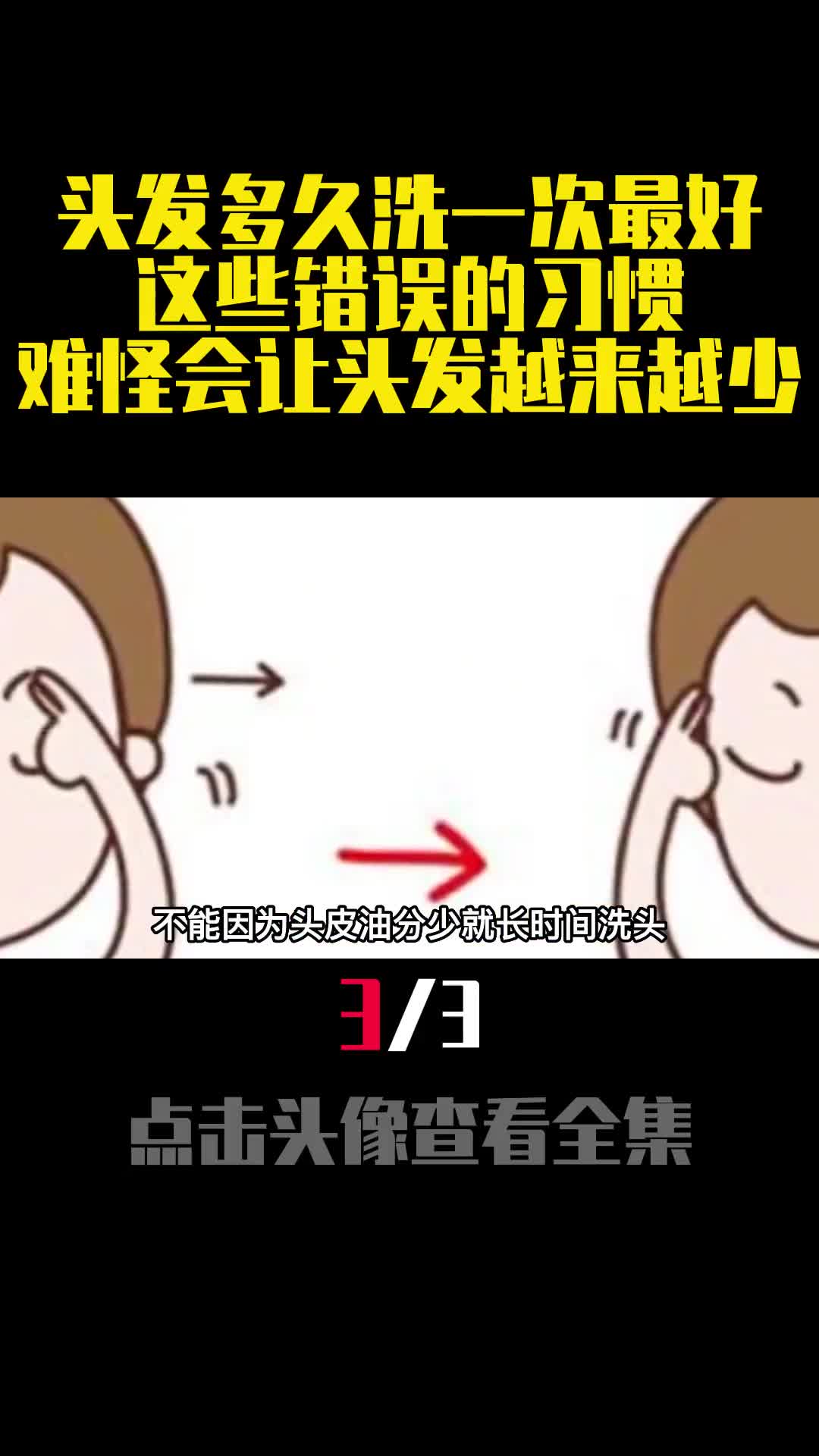 头发多久洗一次最好这些错误的习惯难怪会让头发越来越少3