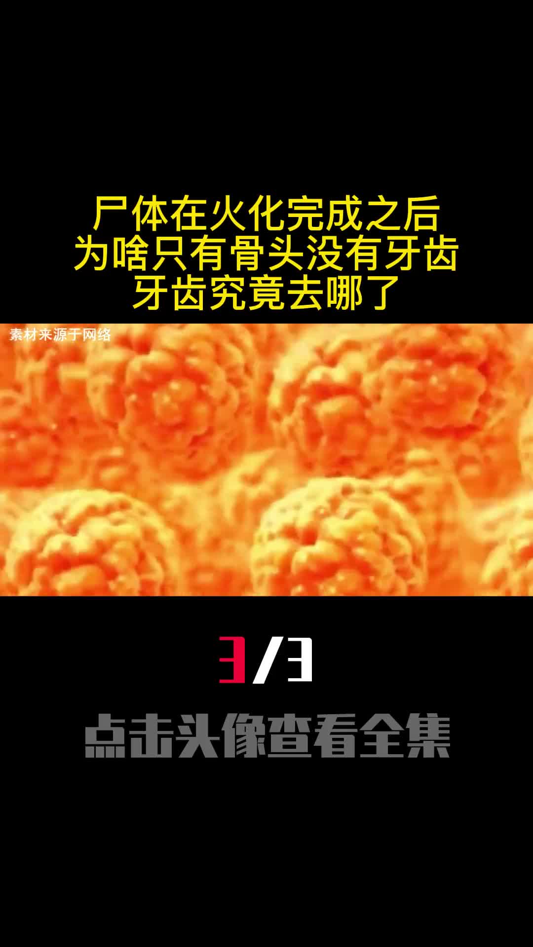 尸体在火化完成之后为啥只有骨头没有牙齿牙齿究竟去哪了3