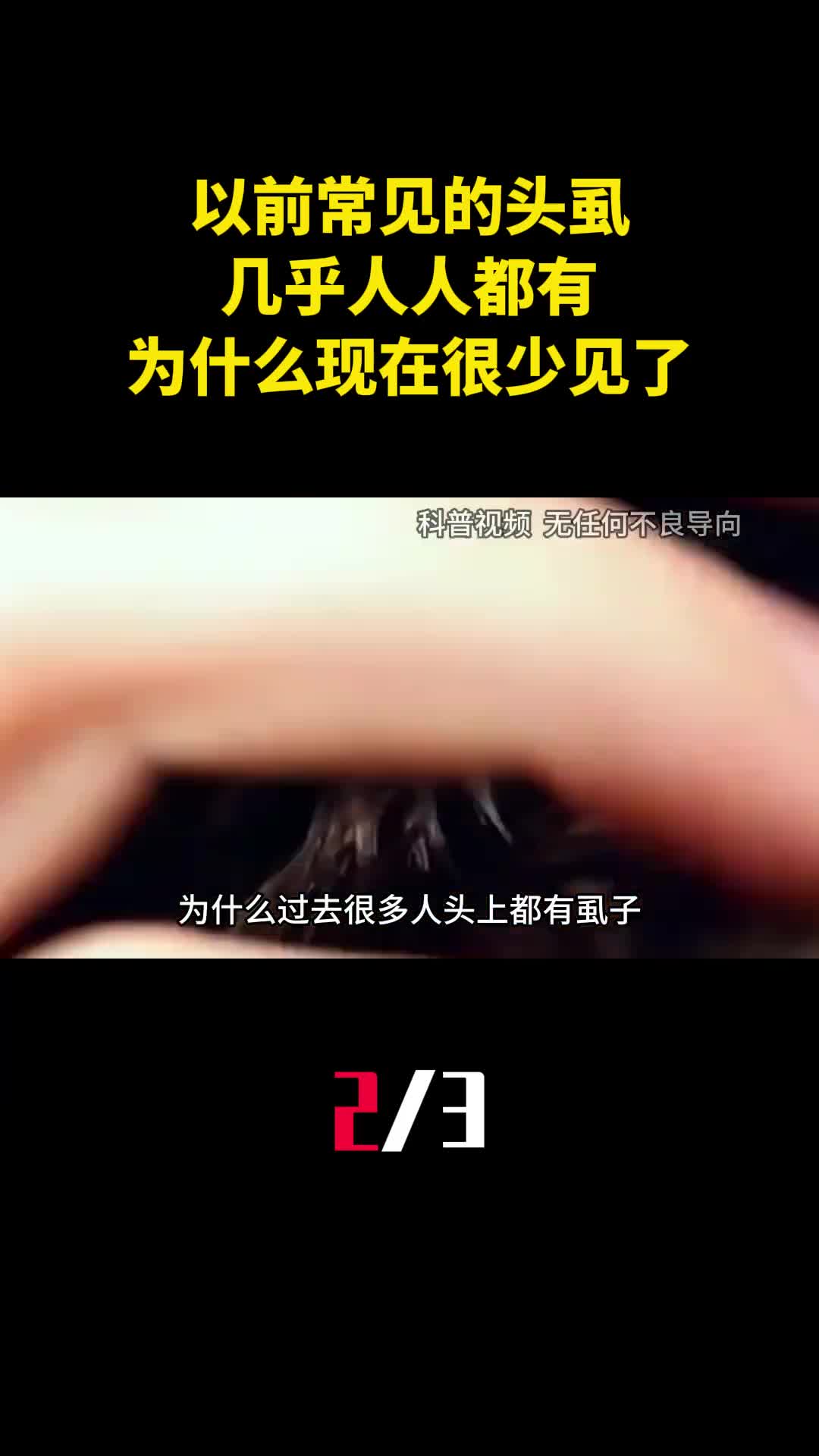 以前常见的头虱几乎人人都有为什么现在很少见了2