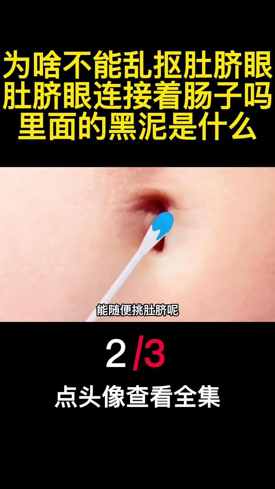 为啥不能乱抠肚脐眼肚脐眼连接这肠子吗里面的黑泥是什么2