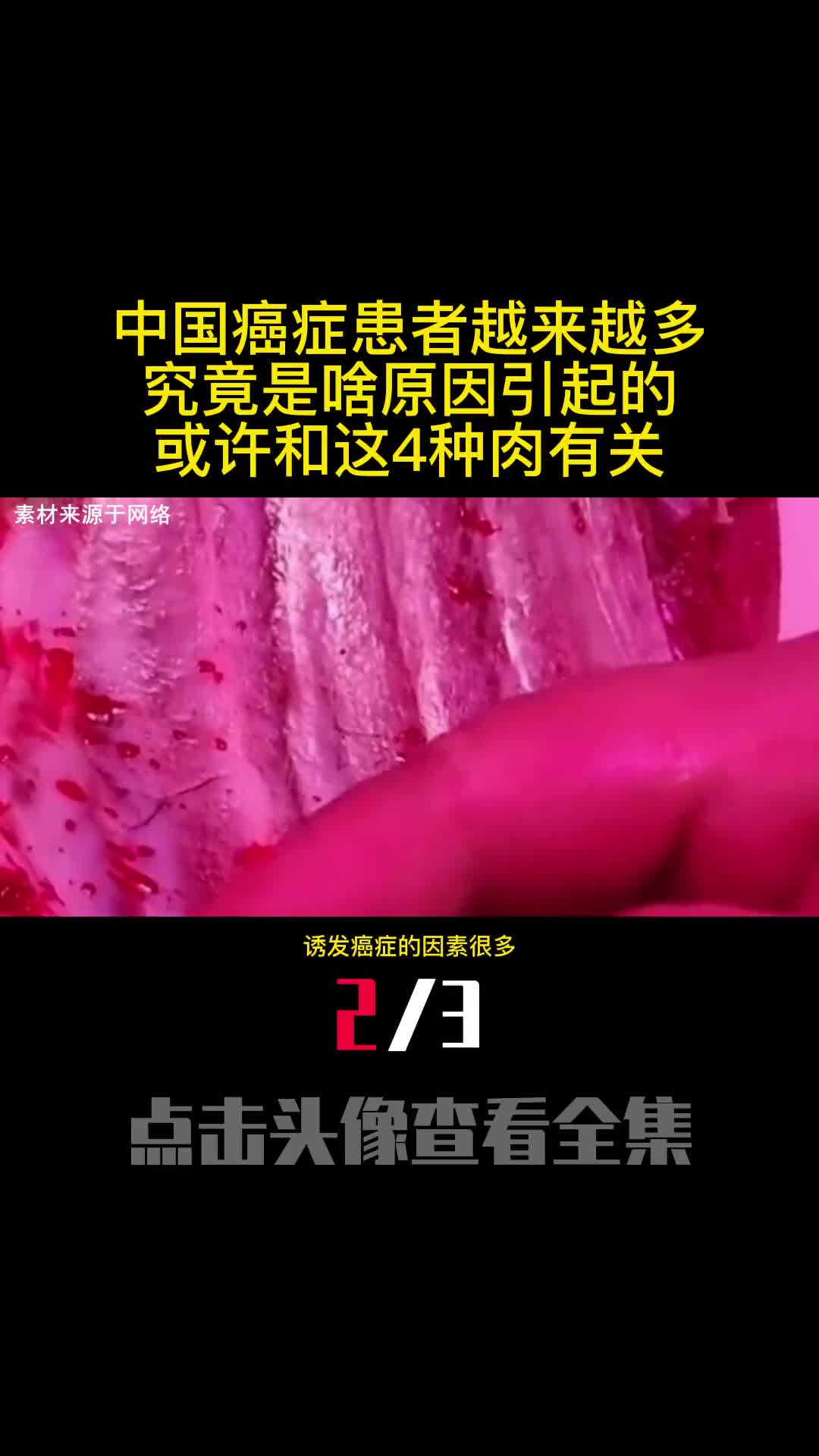中国癌症患者越来越多究竟是啥原因引起的或许和这4种肉有关2