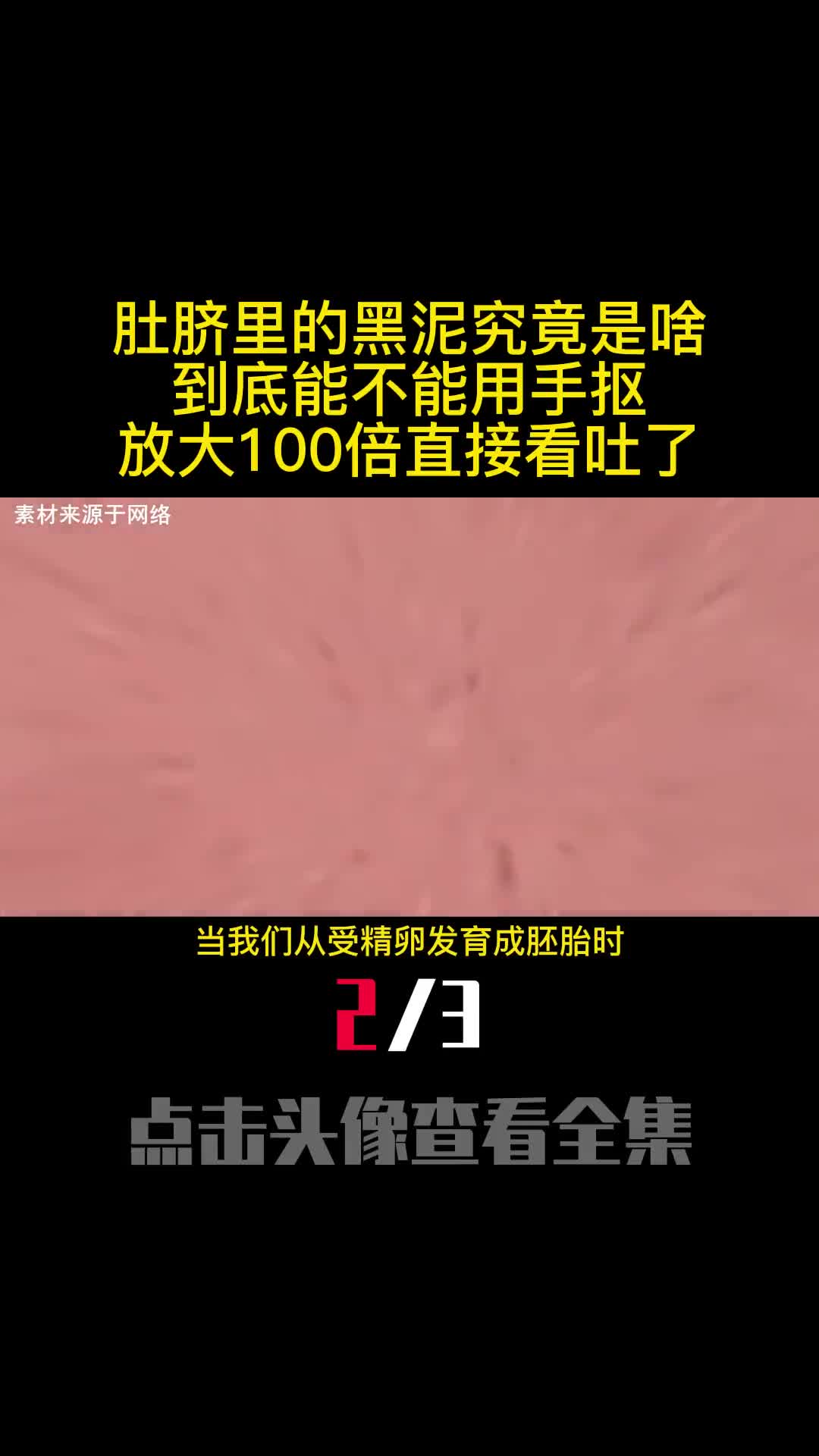 肚脐里的黑泥究竟是啥到底能不能用手抠放大100倍直接看吐了2