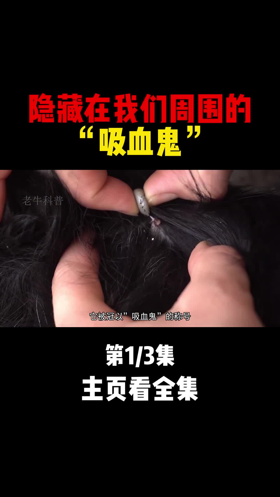 被蜱虫咬了该如何处理又该如何预防1