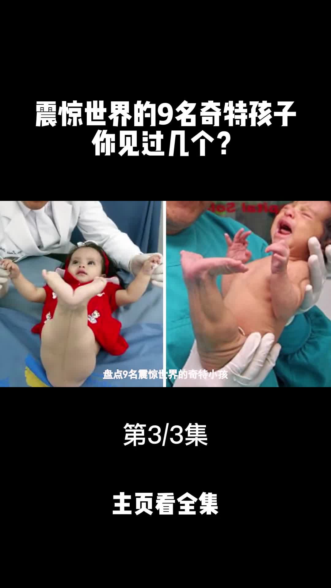 震惊世界的奇特九名小孩你见过几个