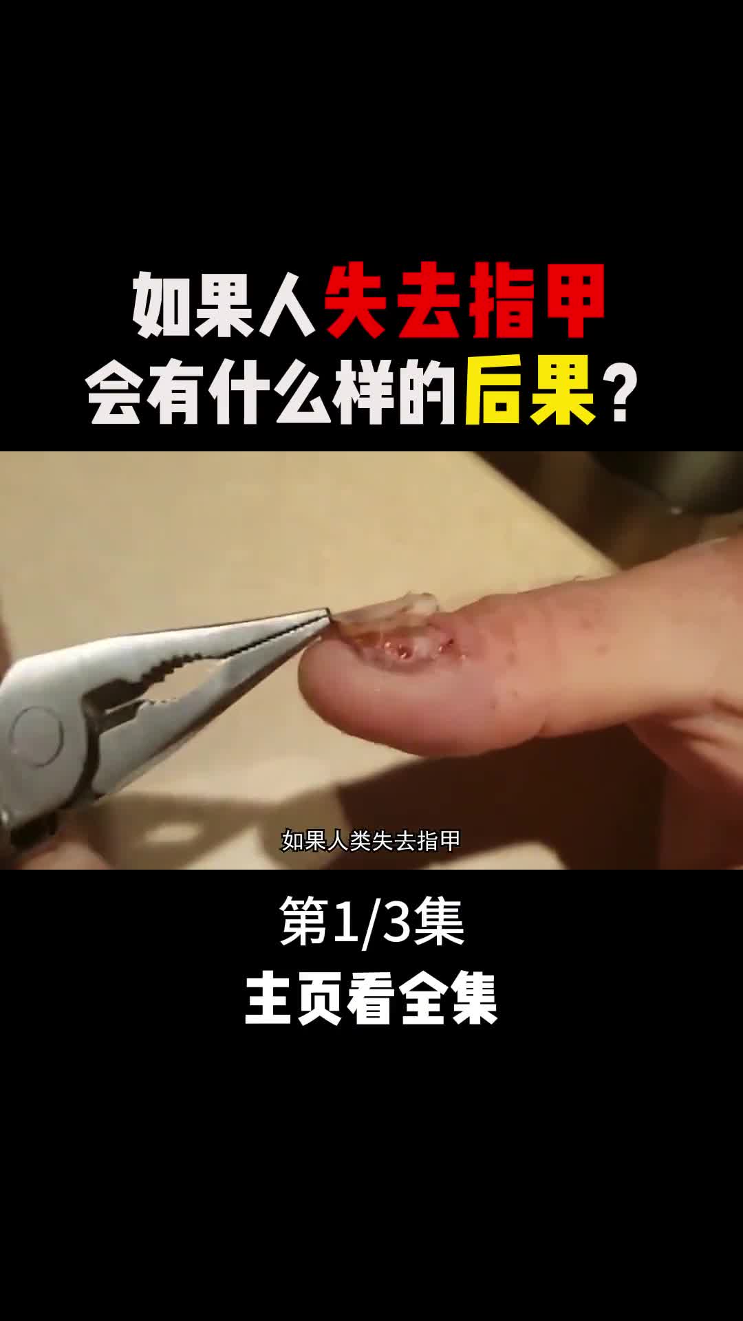如果人一旦失去指甲会出现什么样的后果