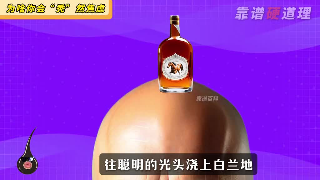 你秃如其来的烦恼大都都来自生活这些坏习惯