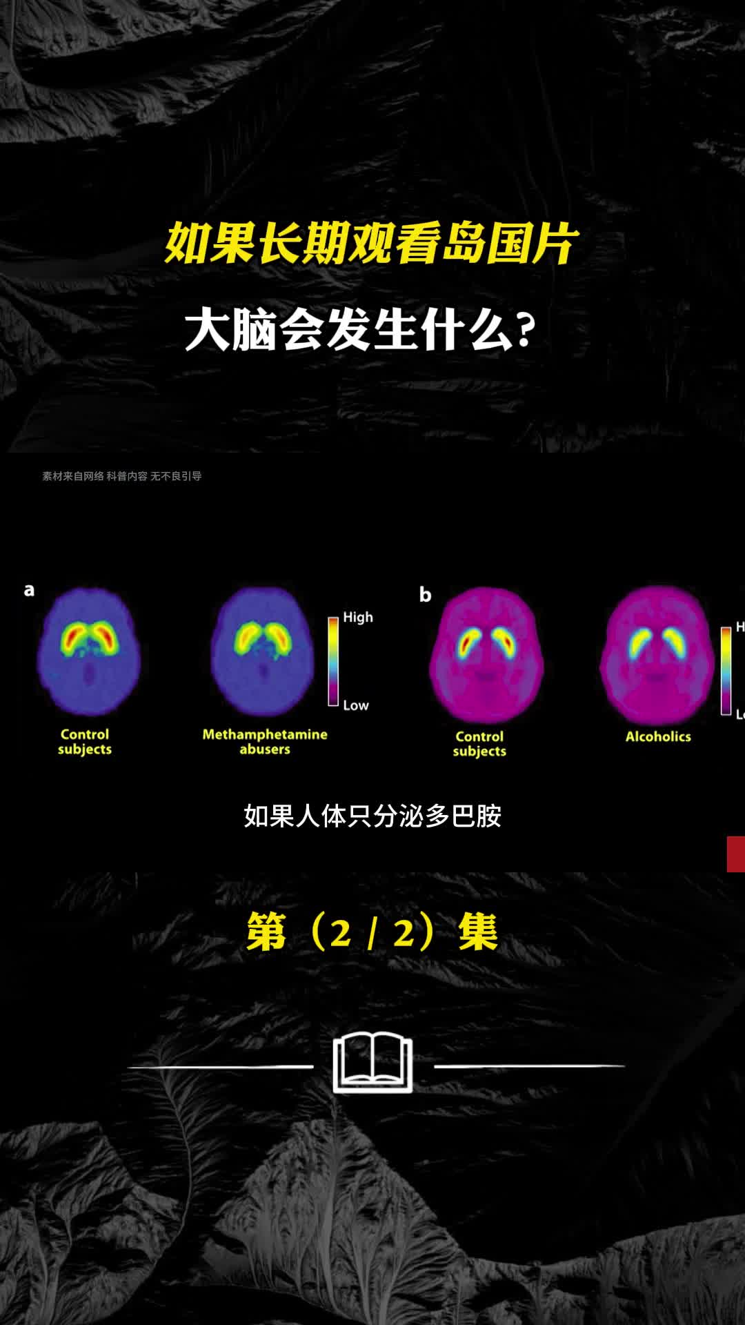 多巴胺过多的危害色瘾成性大脑会发生什么变化
