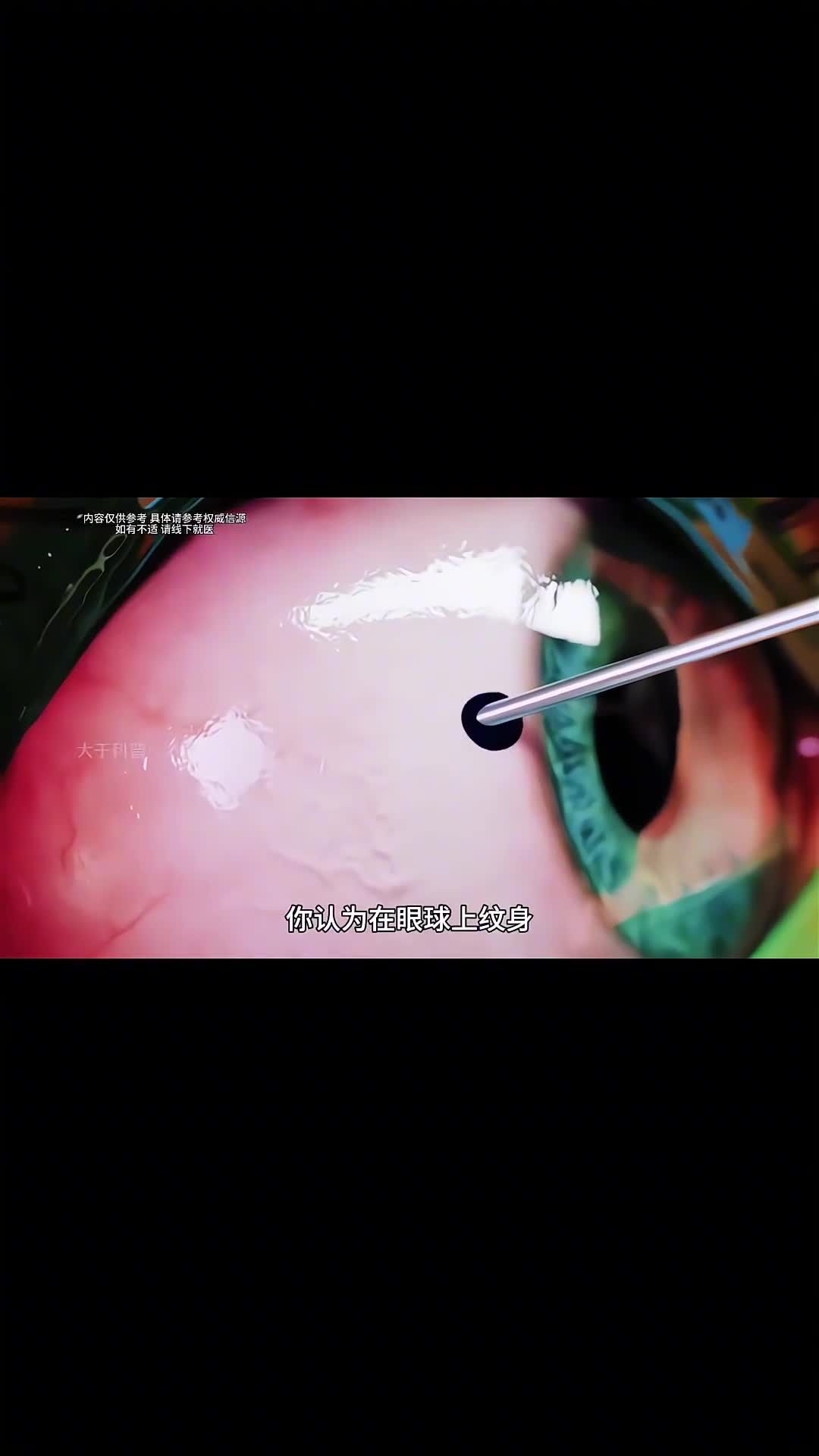 在眼球上纹身有多可怕在眼球上纹身有多可怕