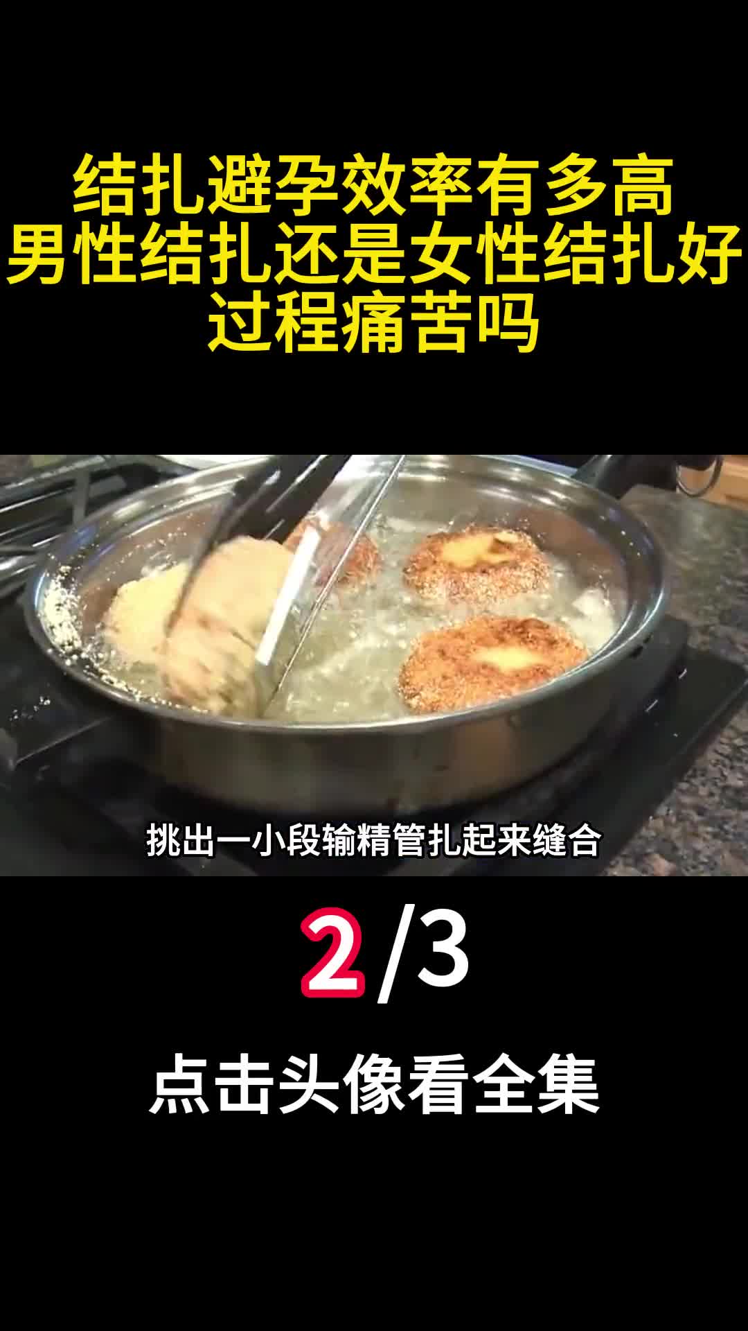 结扎避孕效率有多高男性结扎还是女性结扎好过程痛苦吗2