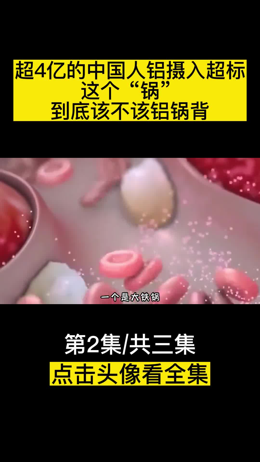 超4亿的中国人铝摄入超标这个锅到底该不该铝锅背