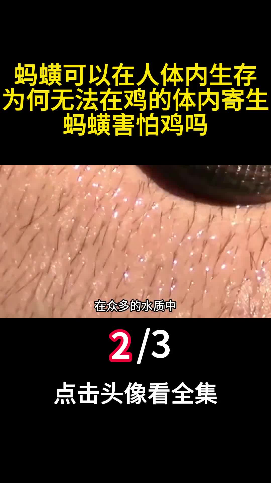 蚂蟥可以在人体内生存为何无法在鸡的体内寄生蚂蟥害怕鸡吗2