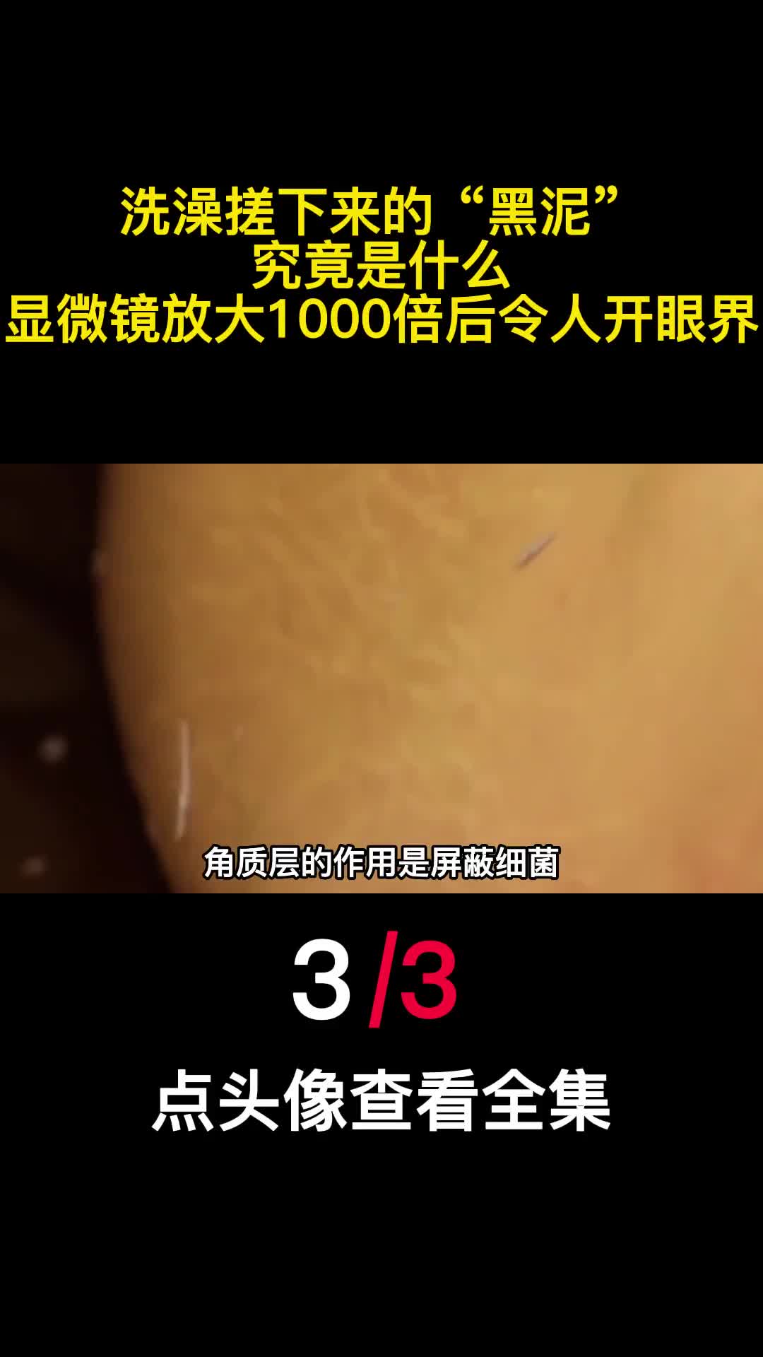洗澡搓下来的黑泥究竟是什么显微镜放大1000倍后令人开眼界3