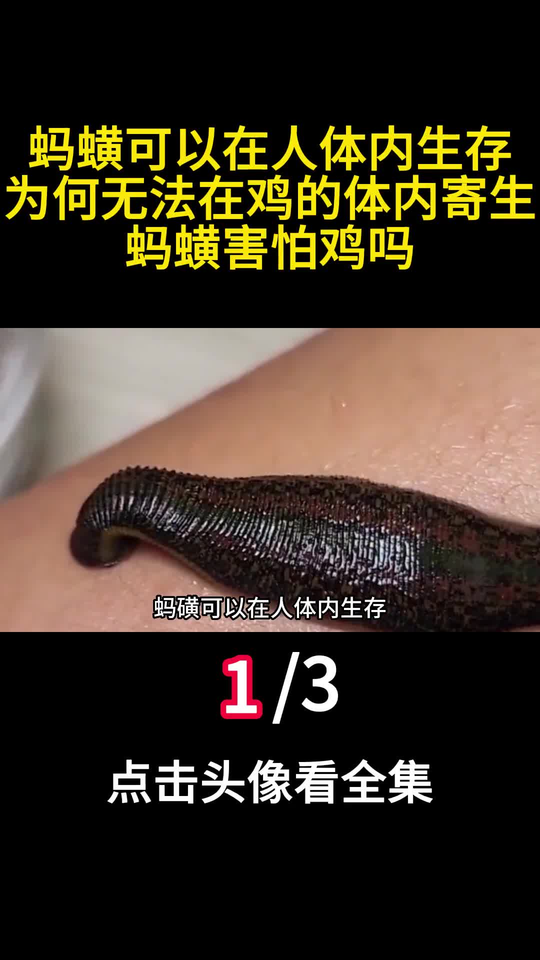 蚂蟥可以在人体内生存为何无法在鸡的体内寄生蚂蟥害怕鸡吗1