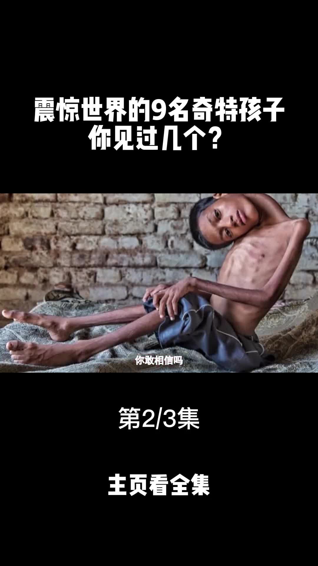 震惊世界的奇特九名小孩你见过几个