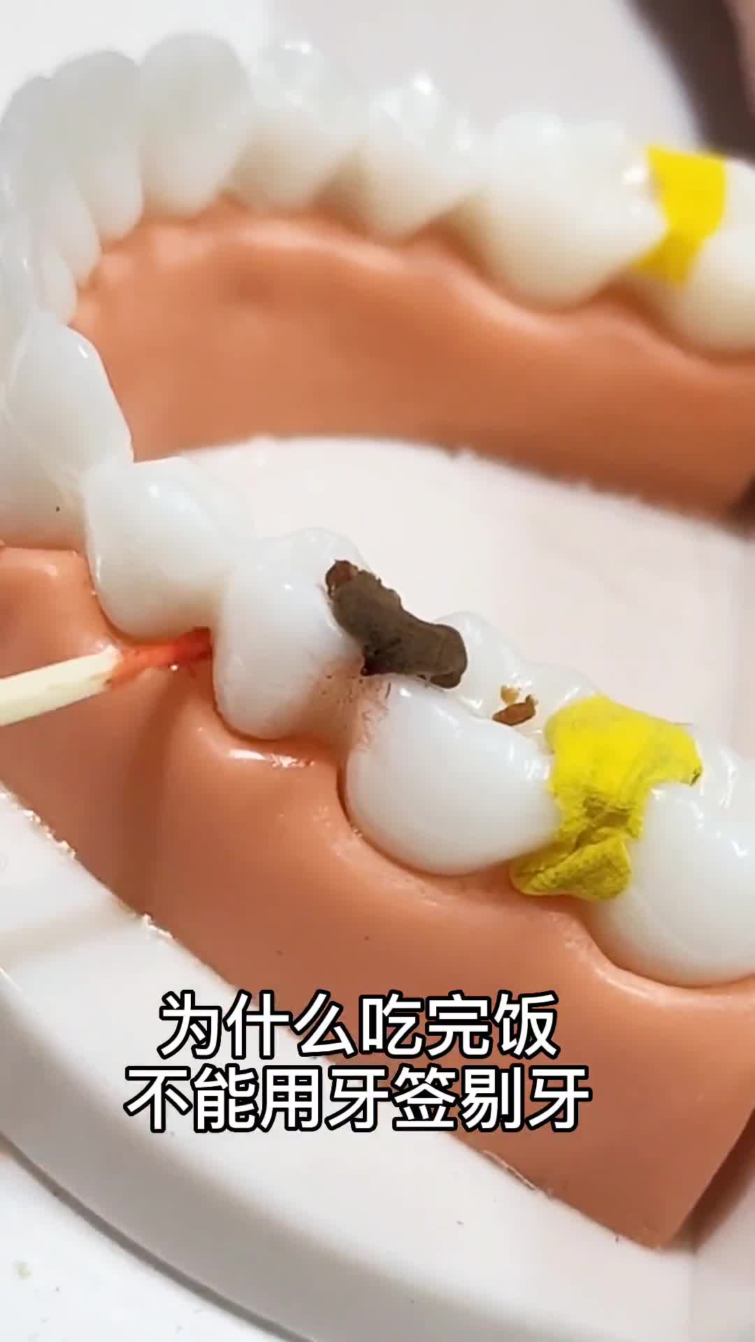 自从用了牙线牙齿干净多了再也牙疼啦