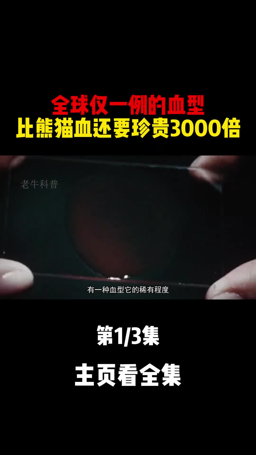 全球仅一例的血型比熊猫血还要珍贵3000倍