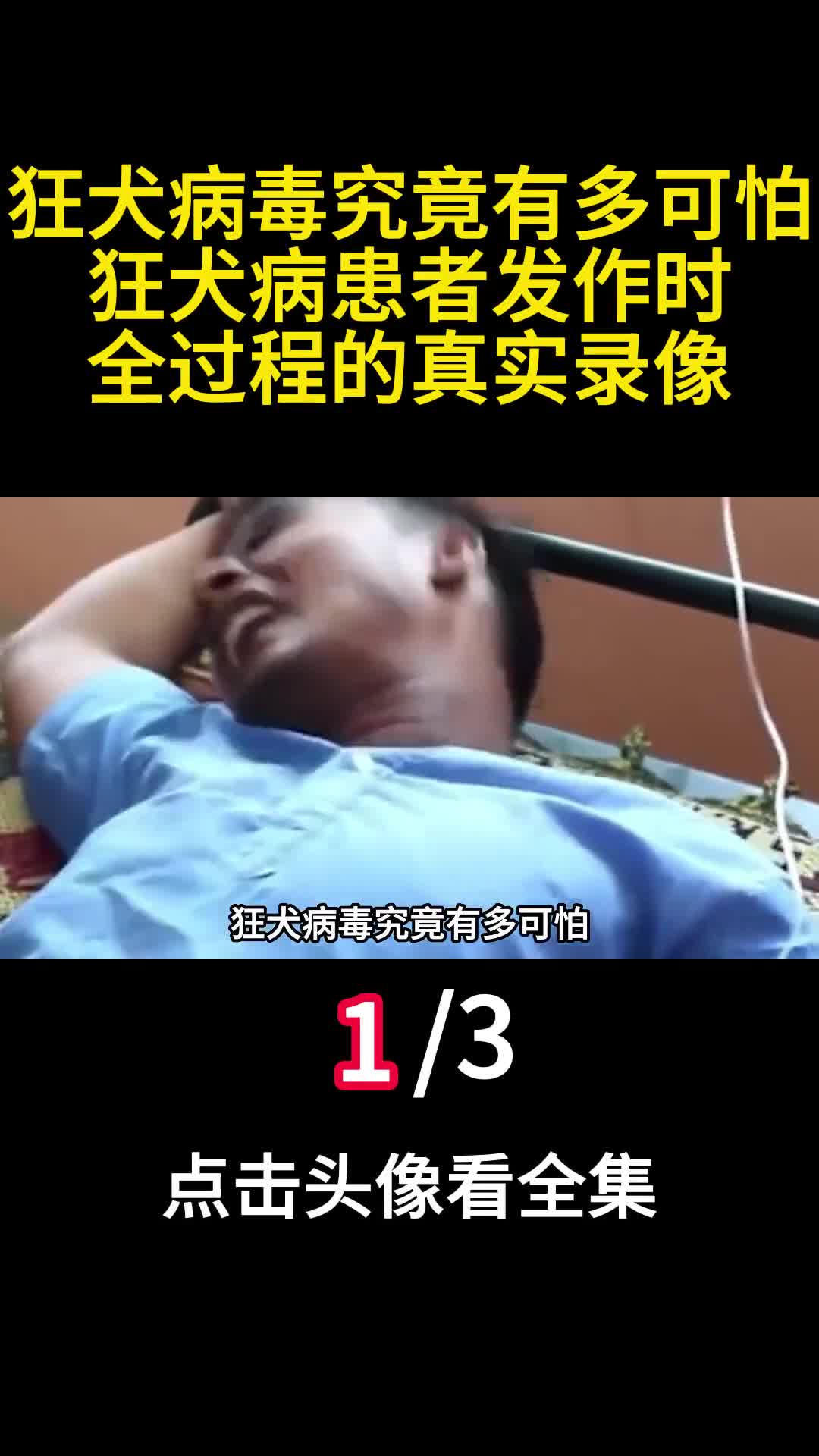 狂犬病毒究竟有多可怕狂犬病患者发作时全过程的真实录像1