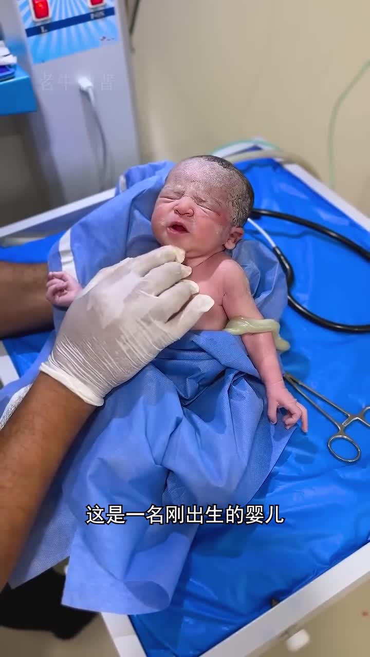 宝宝的莫罗反应