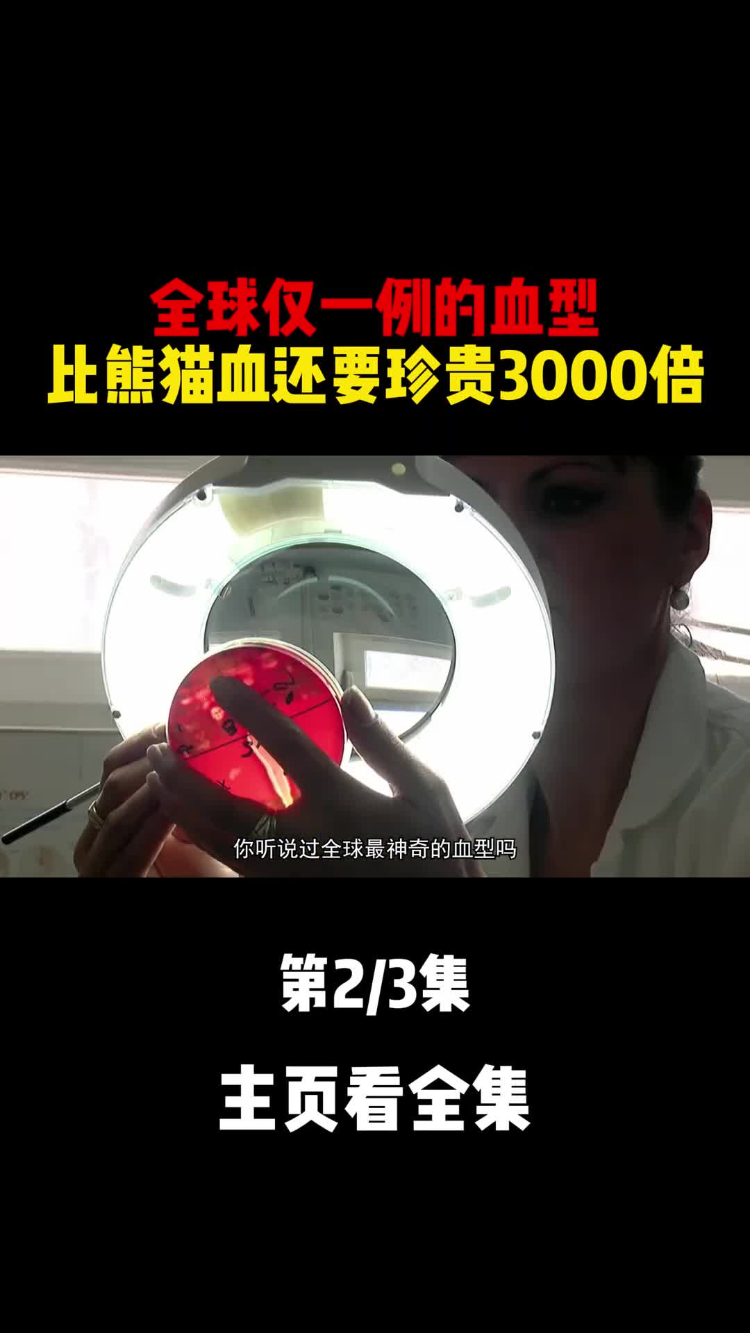 全球仅一例的血型比熊猫血还要珍贵3000倍