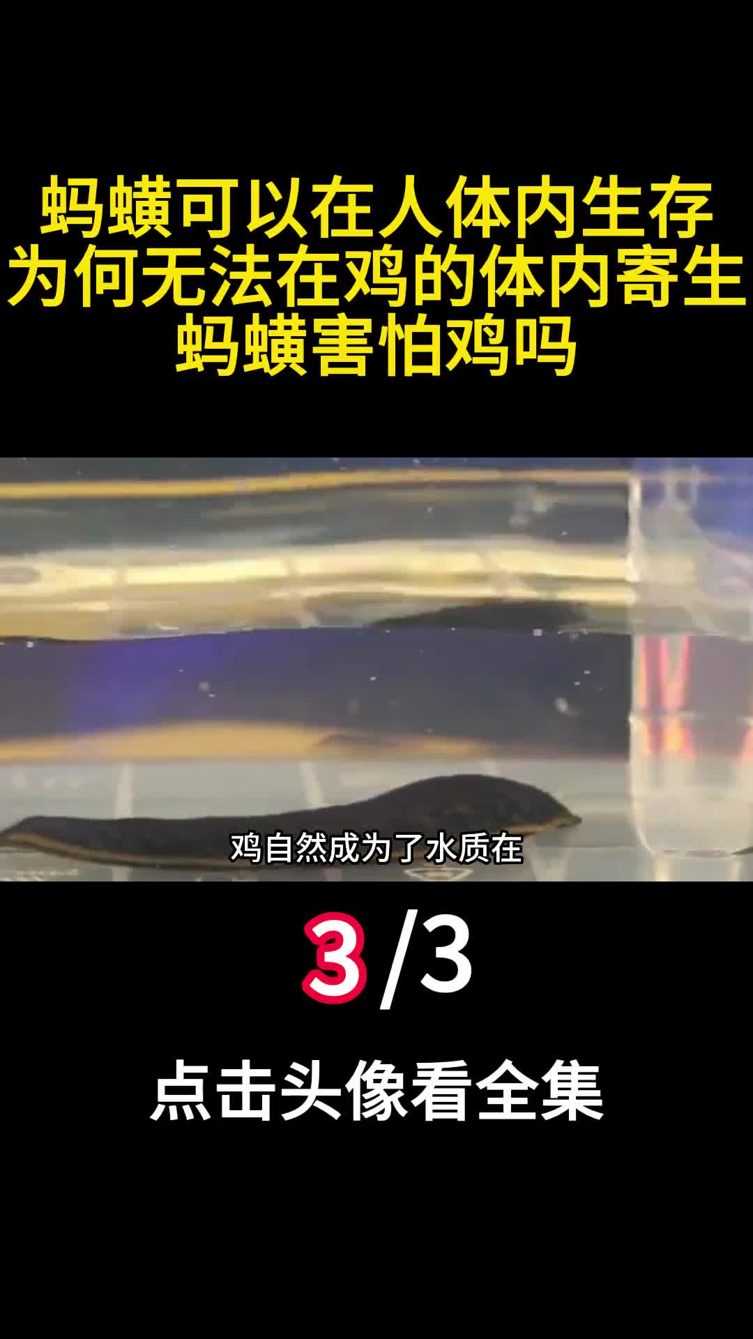 蚂蟥可以在人体内生存为何无法在鸡的体内寄生蚂蟥害怕鸡吗3