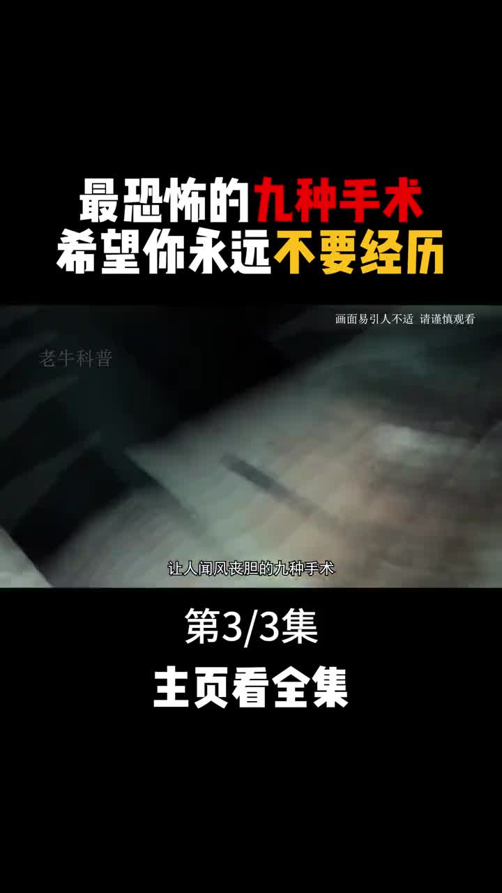 一辈子都不愿体验的九大恐怖手术各个让人毛骨悚然3