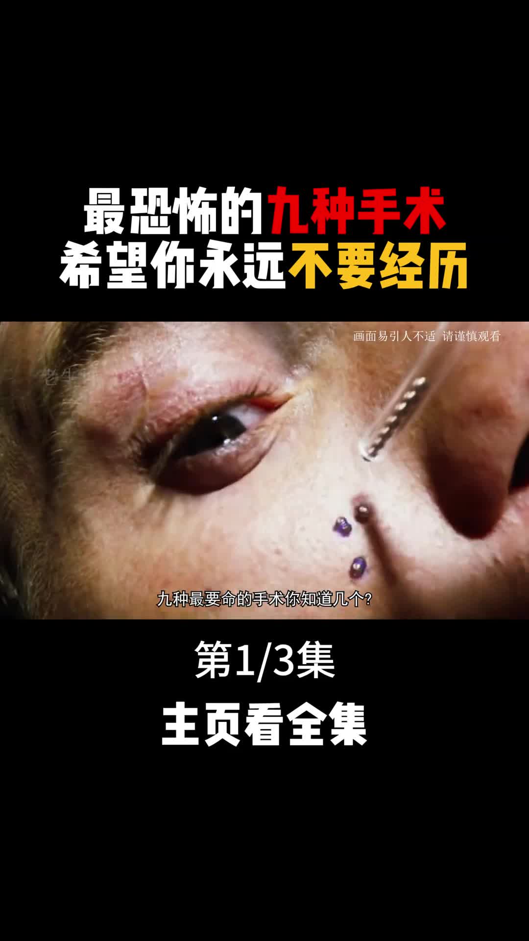 一辈子都不愿体验的九大恐怖手术各个让人毛骨悚然1