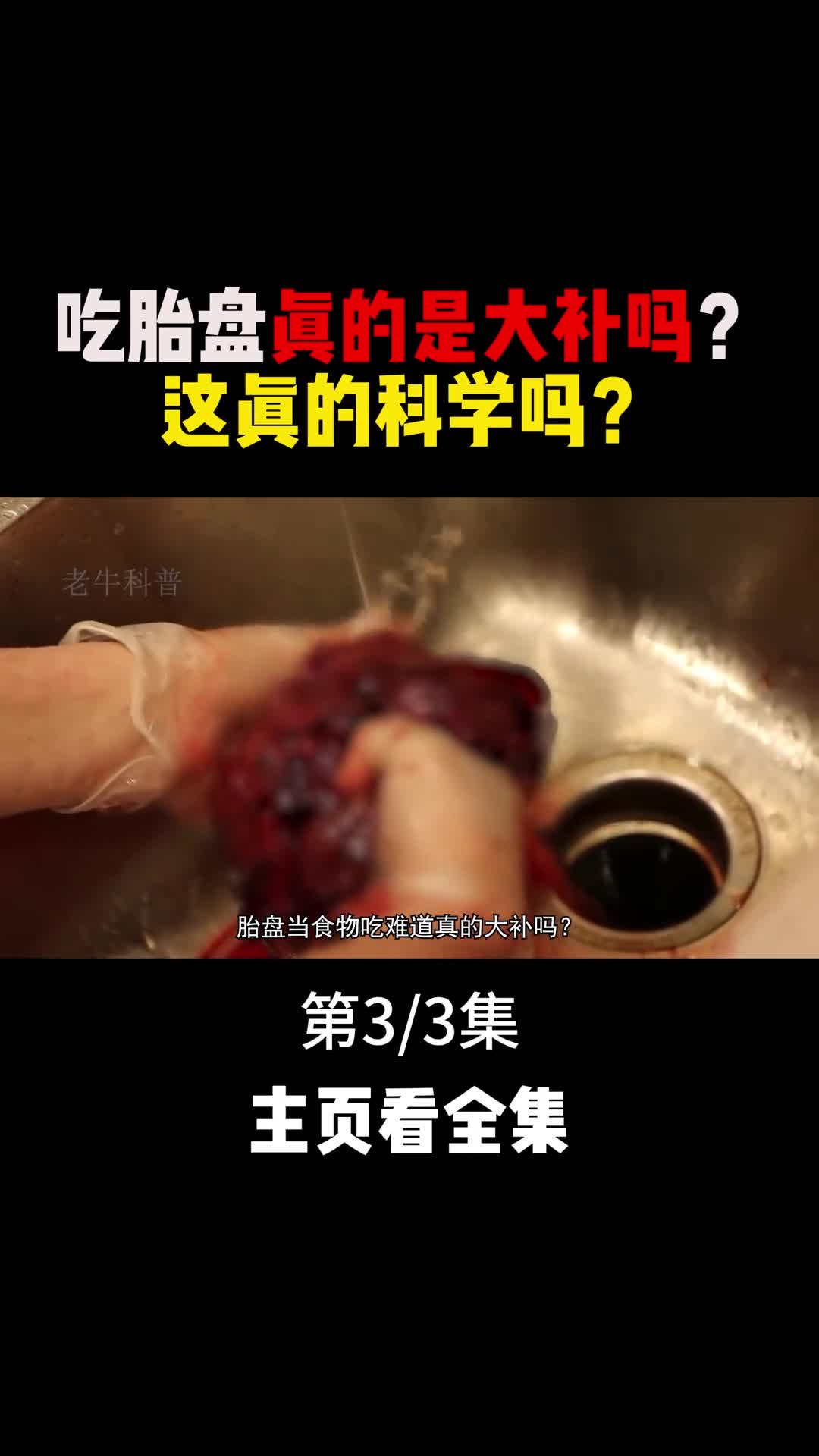 手撕胎盘是每位妈妈的噩梦世界上每位母亲都值得被尊敬3