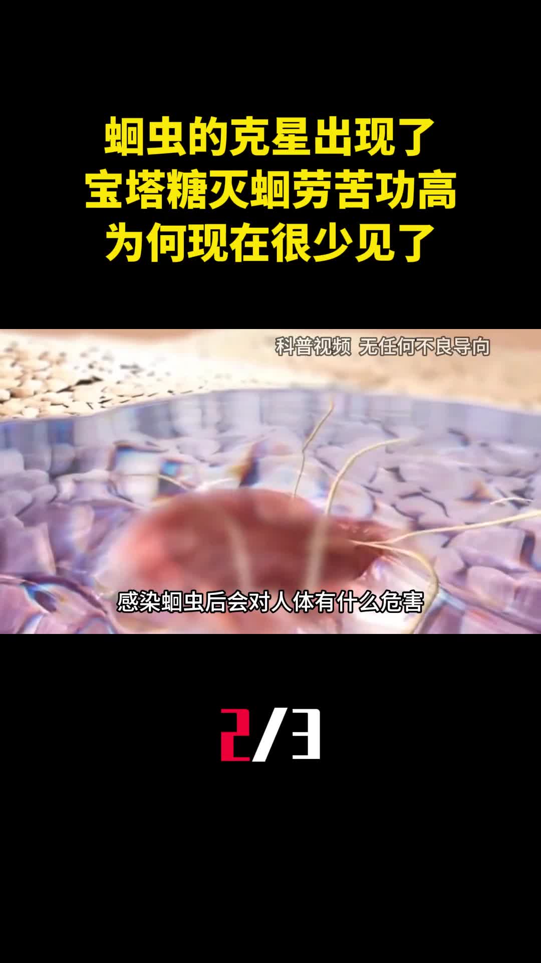 蛔虫的克星出现了宝塔糖灭蛔劳苦功高为何现在很少见了2