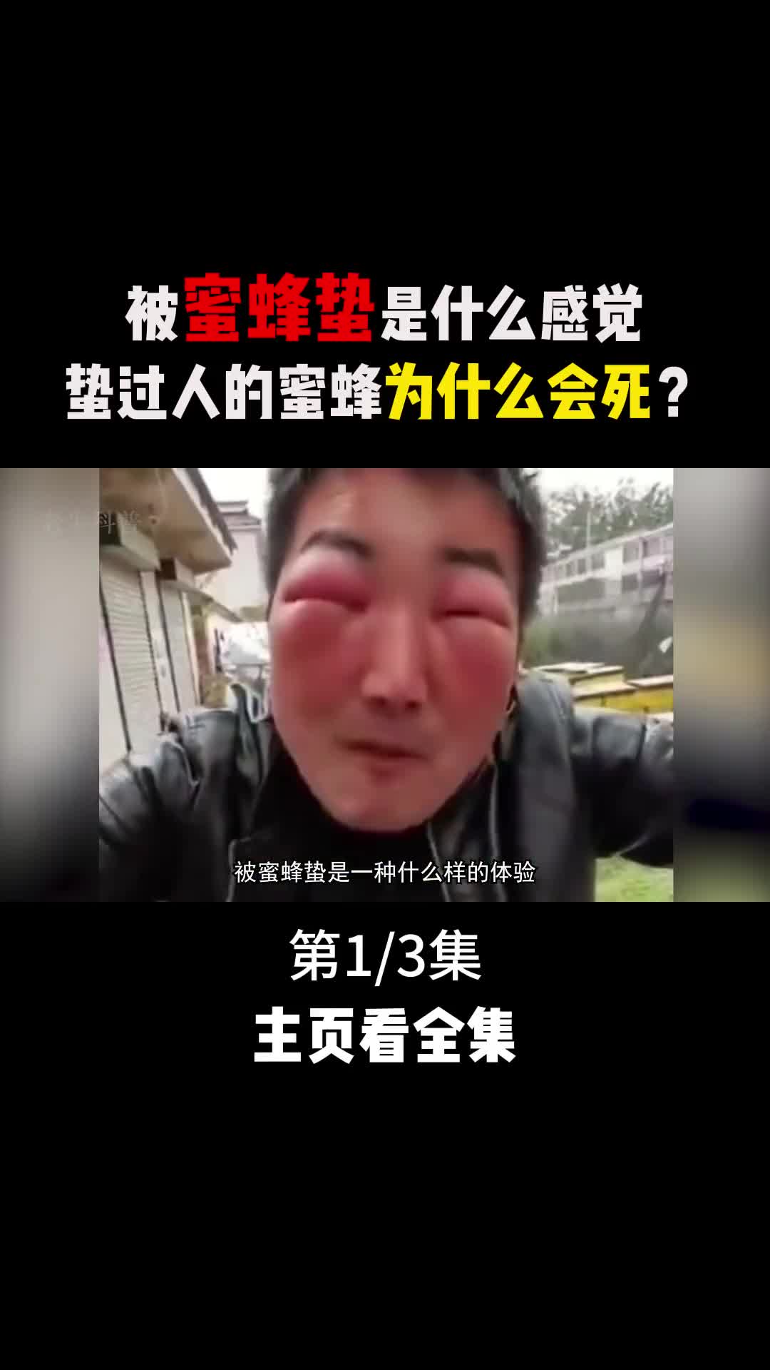 被蜜蜂蛰是一种什么样的体验为什么蛰过人的蜜蜂会丧命1