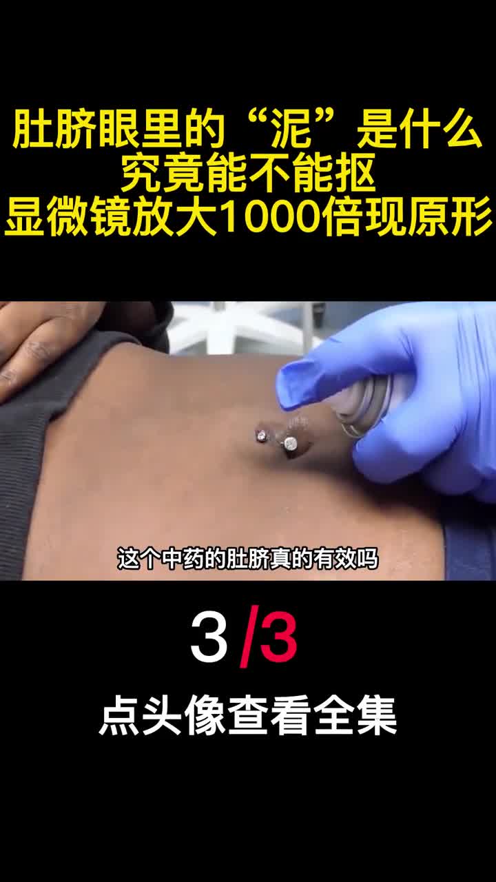 肚脐眼里的泥是什么究竟能不能抠显微镜放大1000倍现原形3