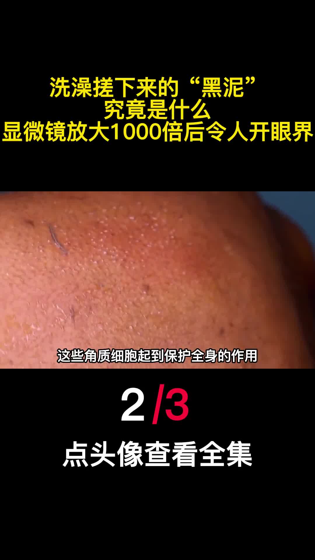 洗澡搓下来的黑泥究竟是什么显微镜放大1000倍后令人开眼界2