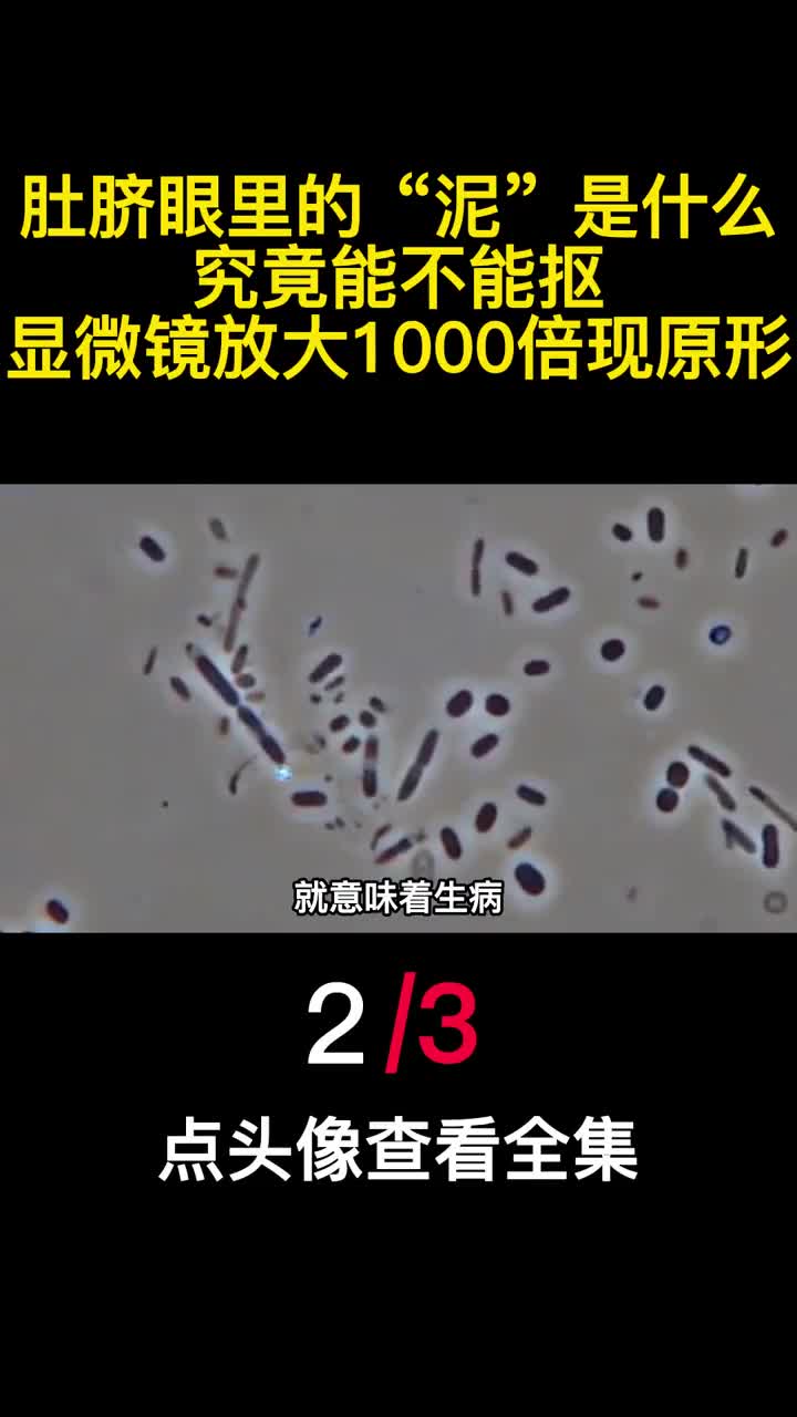 肚脐眼里的泥是什么究竟能不能抠显微镜放大1000倍现原形2