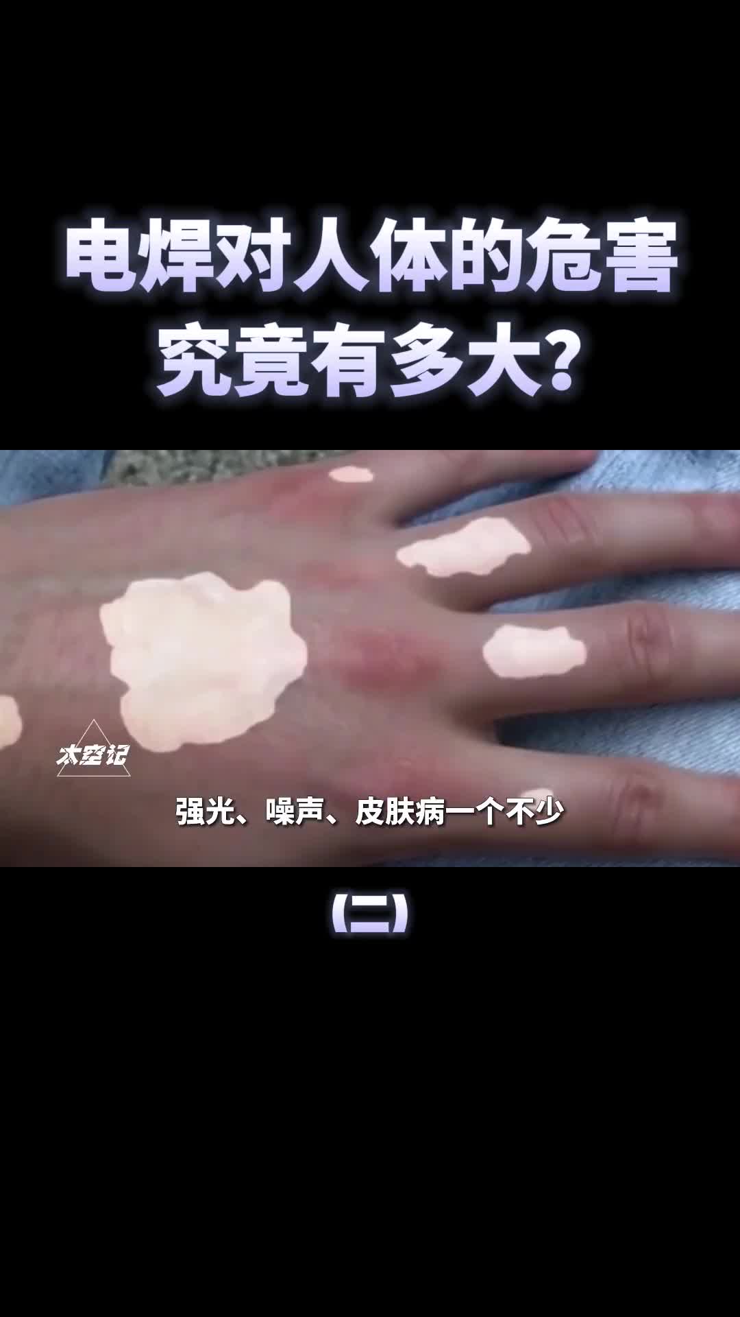 月入过万也笑不出来电焊的危害有多大真会影响男性生育