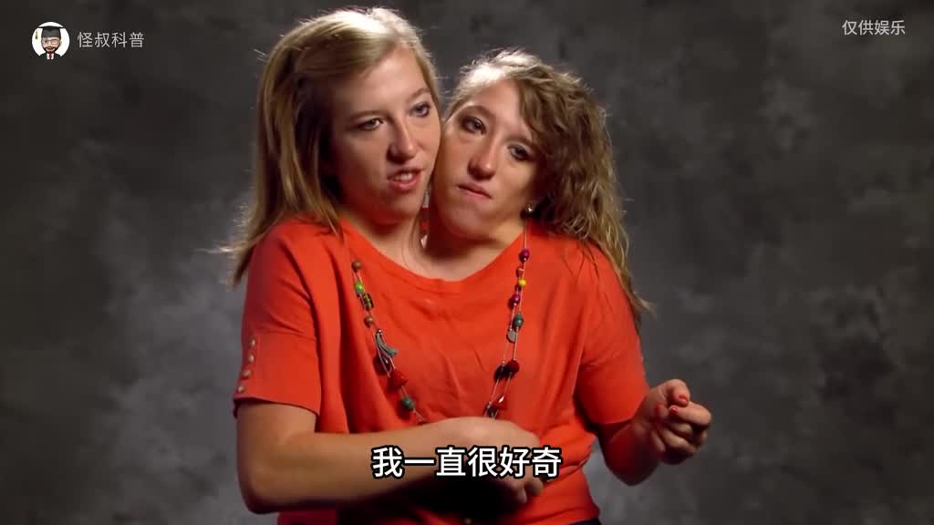 连体人是什么原因导致的