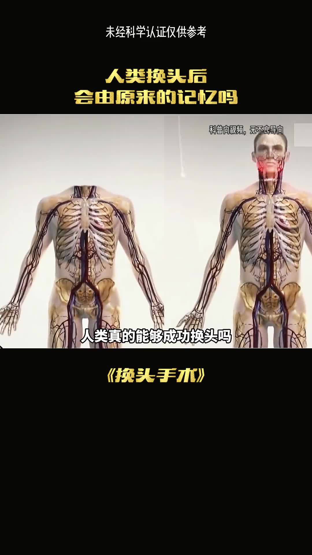 人类真的可以成功换头吗