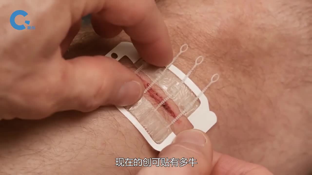 神奇的拉链创口贴轻轻一拉伤口就能缝好原理很简单