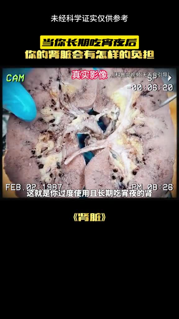 l这就是你管不住嘴的后果