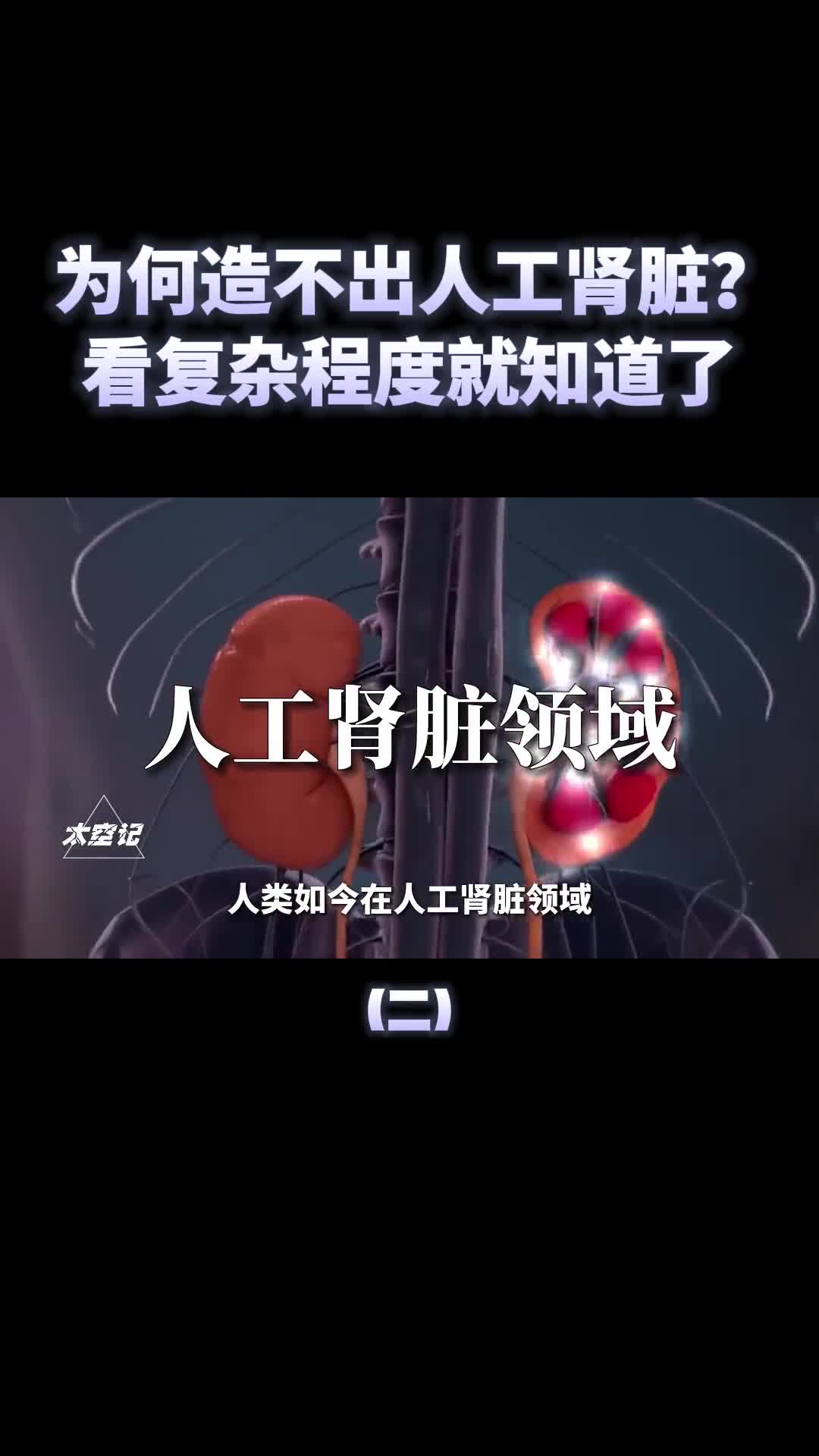 人工心脏都能造为何造不出人工肾脏看复杂程度就知道了