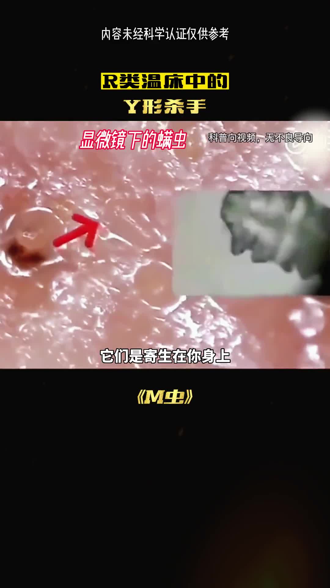 他们是寄生在你身上的诡异生物