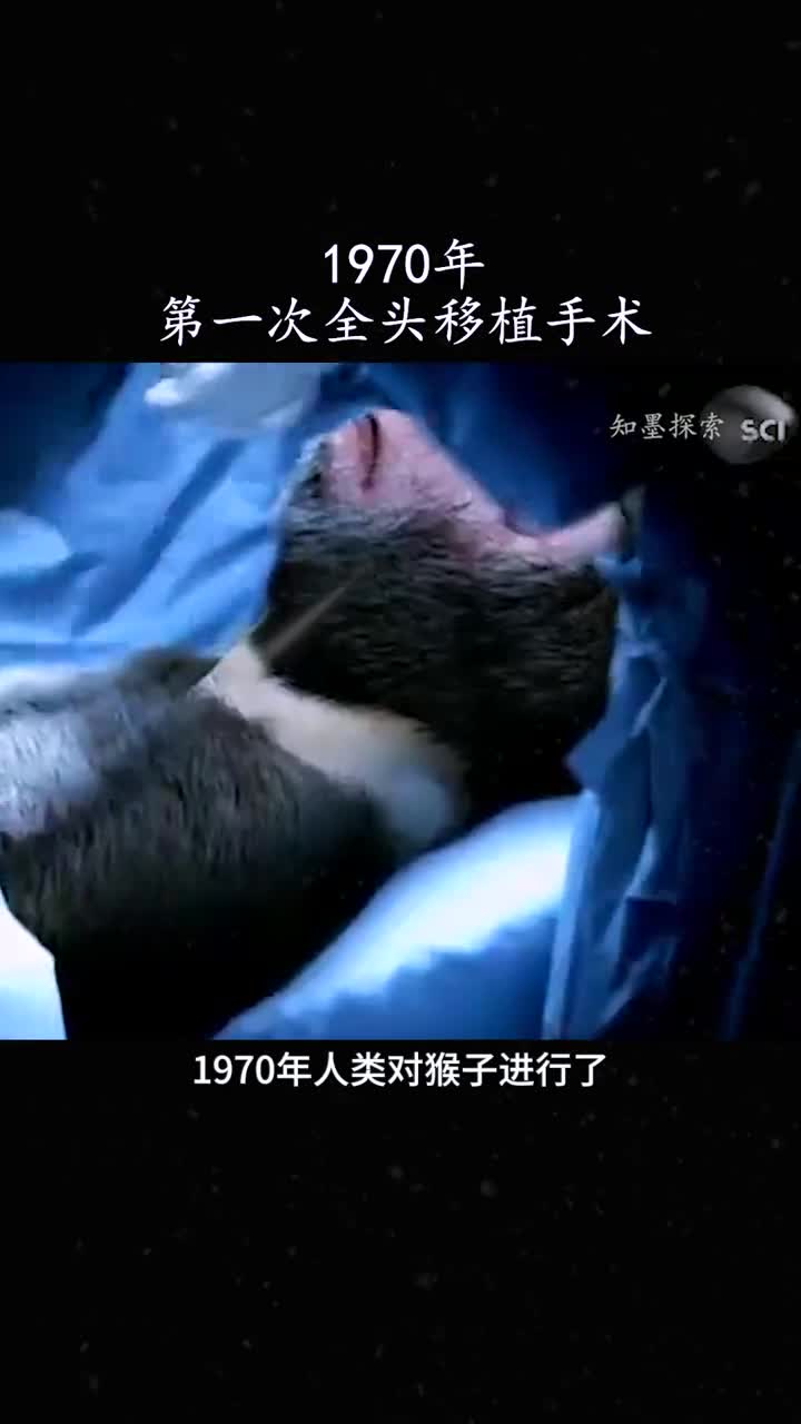 1970年人类对猴子进行了头部移植