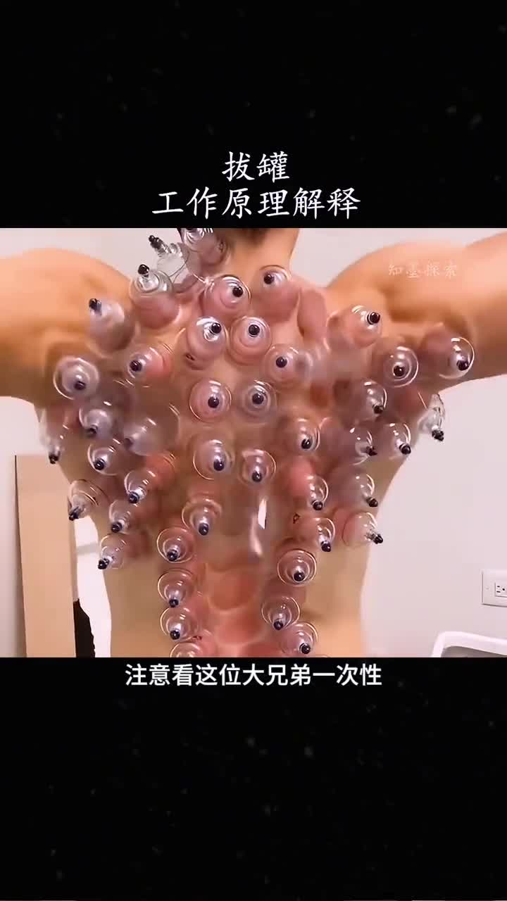 拔罐的工作原理解释