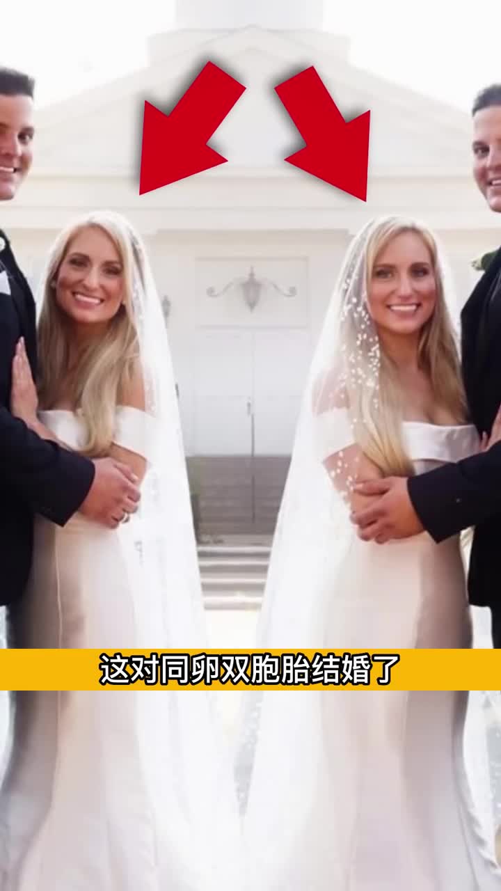 同卵双胞胎夫妻同一时间生出孩子