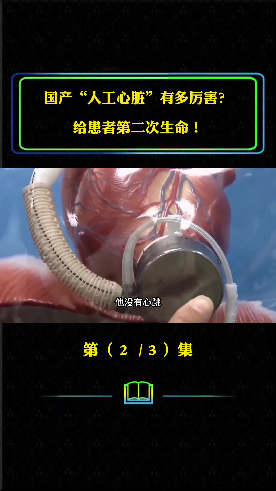 国产磁悬浮人工心脏有多牛给患者第二次生命