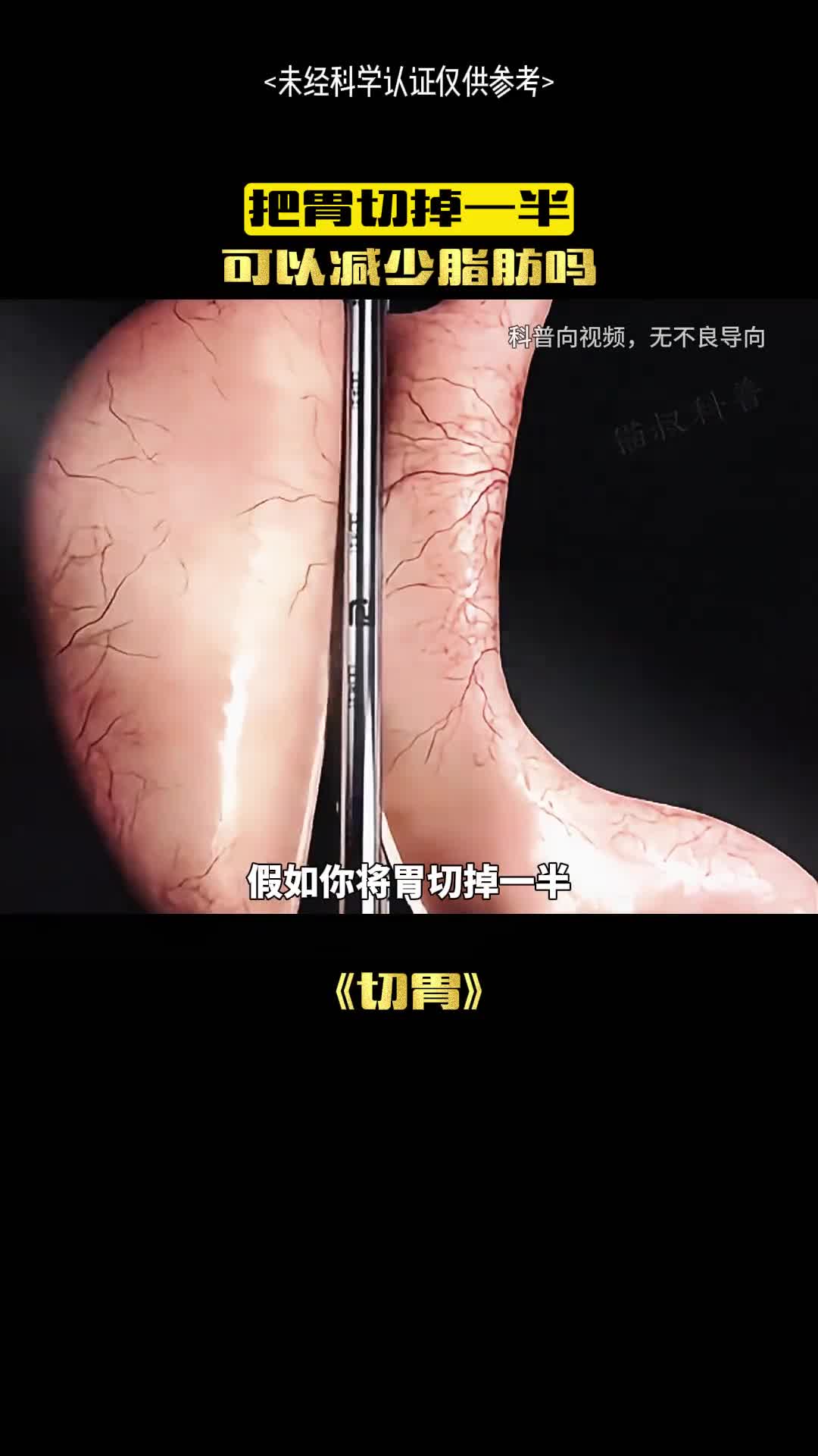 切掉一半的胃真能减少食欲吗