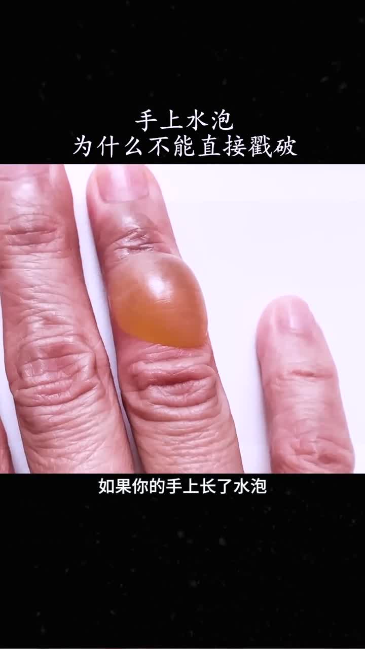 为什么不能直接戳破水泡解释