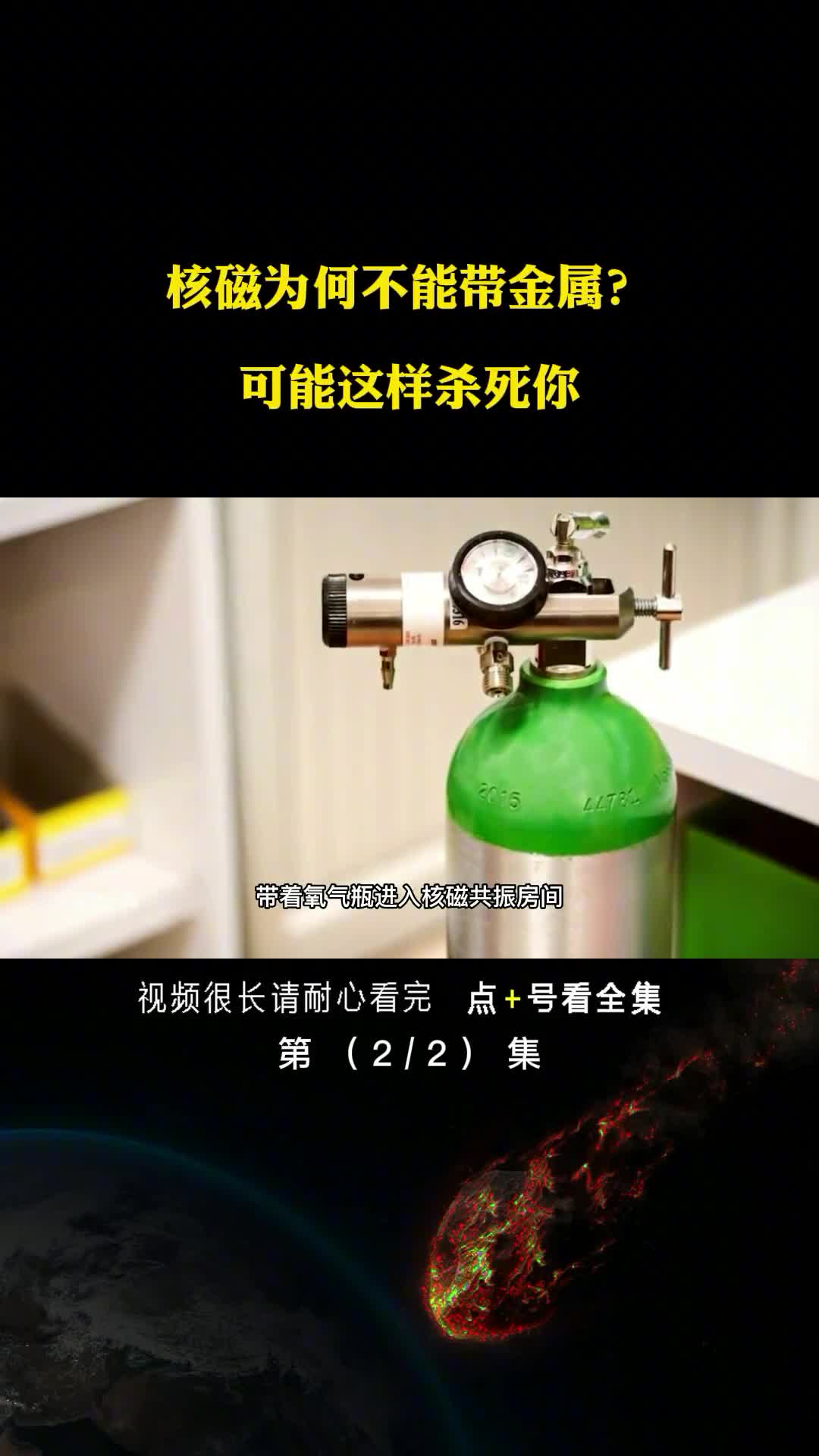核磁共振磁力强度是地球的5万倍检查时别带金属不然会被夹死