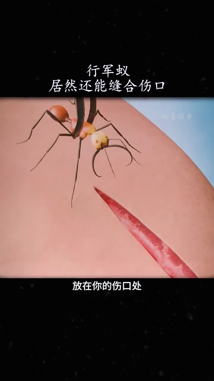 行军蚁居然还能充当缝线
