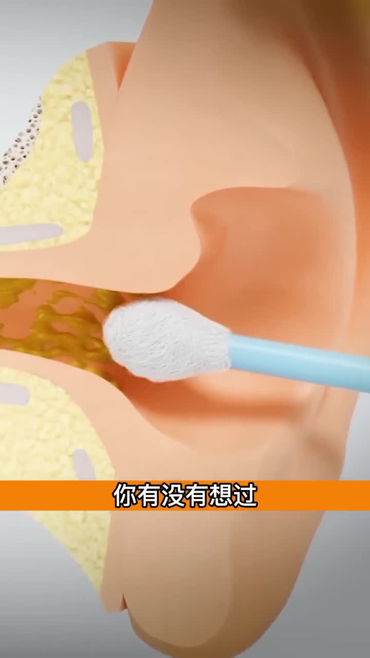 为什么棉签掏耳朵会痒